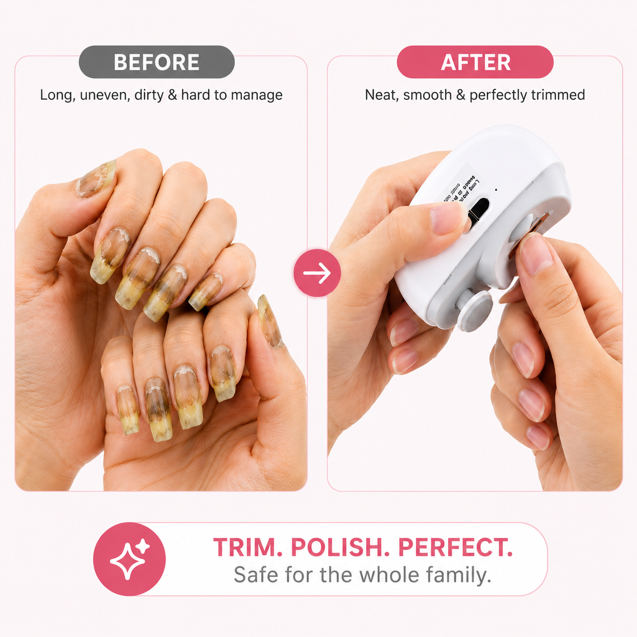 Alenoas™ Smart Nail Clipper